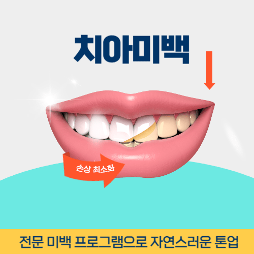 김천치과 김천시 치과 치아미백