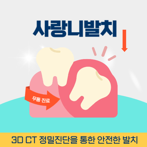 김천치과 김천시 치과 사랑니 발치